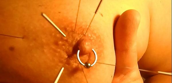  Play piercing with acupuncture needles